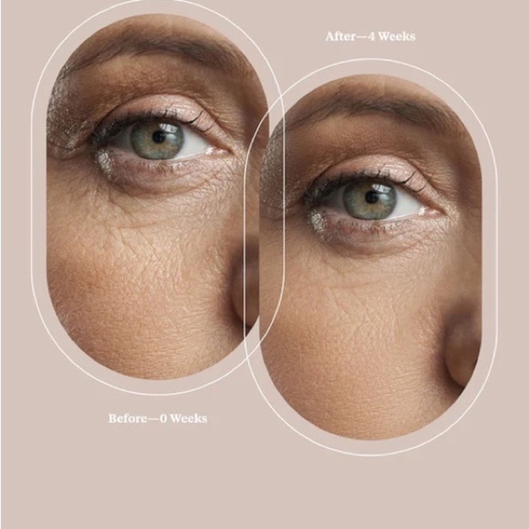 Trophy Skin MiniMD - Picture 8 of 10